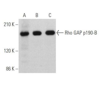 Rho GAP p190-B Antibody (G-11) - Western Blotting - Image 360780 