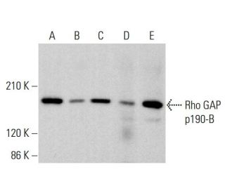 Rho GAP p190-B Antibody (G-11) - Western Blotting - Image 384330 