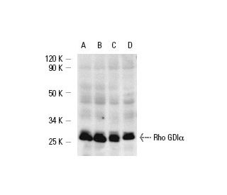 Rho GDI&alpha; Antibody (B-10) - Western Blotting - Image 4216 