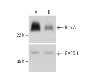 Rho A CRISPR/Cas9 KO Plasmid (h): sc-400052. Western blot analysis of human Rho A expression in empty vector control (A) a