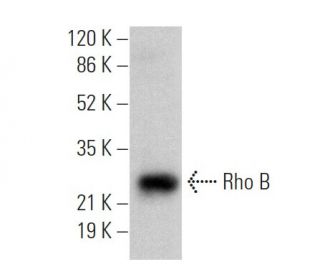 RhoB Antibody (C-5) - Western Blotting - Image 360166Each CRISPR/Cas9 Knockout (KO) Plasmid product consists of a pool of 3 plasmids designed to ensure identification and cleavage of a specific gene for maximum knockout efficiency. Each plasmid encodes a unique 20 nt sequence derived from the GeCKO (v2) library.