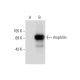 rhophilin Antibody (F-7) - Western Blotting - Image 72470