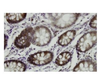 Rhotekin Antibody (AA-18) - Immunohistochemistry - Image 36017 