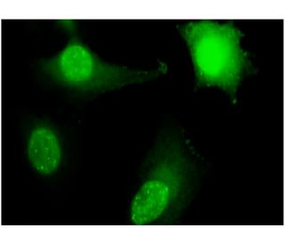 immunohistochemistry image from recommended Ribosomal Protein L11 (2A1) monoclonal antibody replacement. Image 346122
