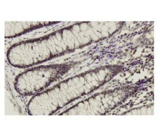 Ribosomal Protein L14 Antibody (KQ-16) - Immunohistochemistry - Image 36176
