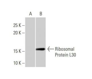 Ribosomal Protein L30 Antibody (4E6) - Western Blotting - Image 352139 