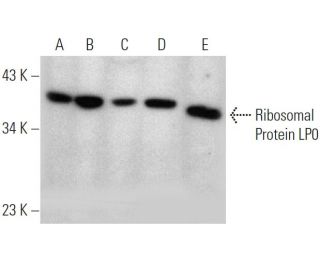 Ribosomal Protein LP0 Antibody (1B4) - Western Blotting - Image 368242Each CRISPR/Cas9 Knockout (KO) Plasmid product consists of a pool of 3 plasmids designed to ensure identification and cleavage of a specific gene for maximum knockout efficiency. Each plasmid encodes a unique 20 nt sequence derived from the GeCKO (v2) library. 