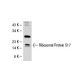 Ribosomal Protein S17 Antibody (40-K) - Western Blotting - Image 31399