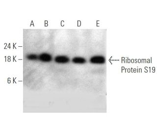 Ribosomal Protein S19 Antibody (WW-4) - Western Blotting - Image 368245 