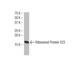 Ribosomal Protein S23 Antibody (SJ-K2) - Western Blotting - Image 34210 