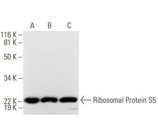 Ribosomal Protein S5 Antibody (A-8) - Western Blotting - Image 290942 