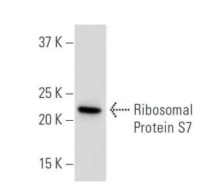 Ribosomal Protein S7 Antibody (44-K) - Western Blotting - Image 34207 
