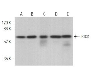 western blotting image from recommended RICK (A-10) monoclonal antibody replacement. Image 373917