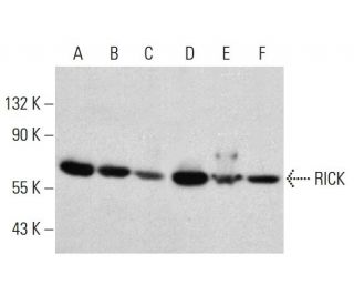 RICK Antibody (25) - Western Blotting - Image 385766