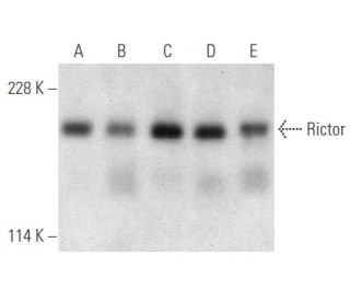 Rictor Antibody (1G11) - Western Blotting - Image 354771 