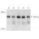 Rictor Antibody (1G11) - Western Blotting - Image 354771 