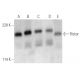 Rictor Antibody (1G11) - Western Blotting - Image 354772 