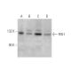 This polyclonal antibody has been discontinued. See our recommended <a href="rig-i-antibody-d-12">RIG-I (D-12)</a> monoclonal antibody (sample data shown). western blotting image from recommended RIG-I (D-12) monoclonal antibody replacement. Image 352707