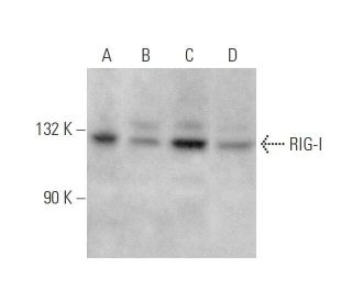 western blotting image from recommended RIG-I (D-12) monoclonal antibody replacement. Image 352707