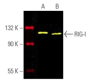 RIG-I Antibody (D-12) - Western Blotting - Image 391070Each CRISPR/Cas9 Knockout (KO) Plasmid product consists of a pool of 3 plasmids designed to ensure identification and cleavage of a specific gene for maximum knockout efficiency. Each plasmid encodes a unique 20 nt sequence derived from the GeCKO (v2) library.