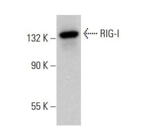 RIG-I Antibody (D-12) - Western Blotting - Image 379183