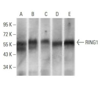 western blotting image from recommended RING1 (8C12F4) monoclonal antibody replacement. Image 358296