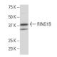 RING1B Antibody (N-32) - Western Blotting - Image 34471