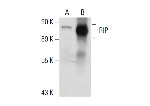 irip antibody irip antibody