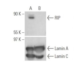 RIP siRNA (h): sc-36426. Western blot analysis of RIP expression in non-transfected control (A) and RIP siRNA transfected 