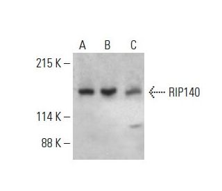 RIP140 Antibody (F-2) - Western Blotting - Image 393519SAM Transcription Activation: SAM system utilizing dCas9-VP64, MS2-P65-HSF1, and sgRNA for precise gene transcription activation.