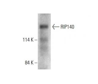 RIP140 Antibody (2656C6a) - Western Blotting - Image 384247Each CRISPR/Cas9 Knockout (KO) Plasmid product consists of a pool of 3 plasmids designed to ensure identification and cleavage of a specific gene for maximum knockout efficiency. Each plasmid encodes a unique 20 nt sequence derived from the GeCKO (v2) library.