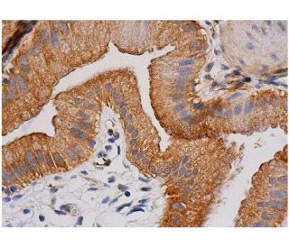 その他 flk040217 FUTURE MIRAGE ファントム ハイヒール スニーカー (レザー