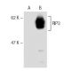 RIP3 Antibody (Rippy-3) - Western Blotting - Image 67454