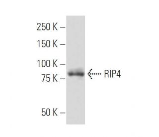 RIP4 Antibody (387.1) - Western Blotting - Image 33801 