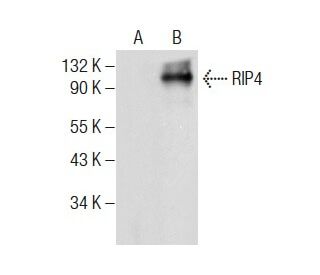 RIP4 Antibody (E-7) - Western Blotting - Image 283871