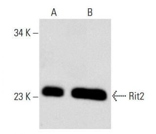 Rit2 Antibody (27G2) - Western Blotting - Image 54045 