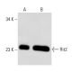 Rit2 Antibody (27G2) - Western Blotting - Image 54045 