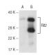 Rit2 Antibody (27G2) - Western Blotting - Image 67299