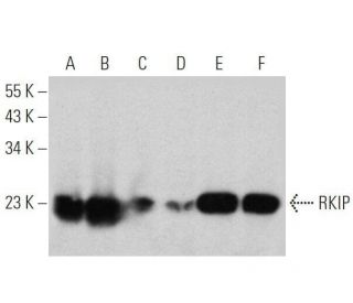RKIP Antibody (8) - Western Blotting - Image 356355 
