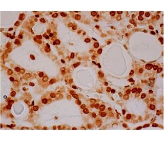 RLF Antibody (D-7) - Immunohistochemistry - Image 286378 