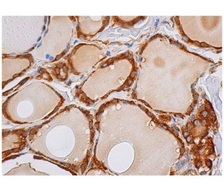 RLF Antibody (E-4) - Immunohistochemistry - Image 343953 