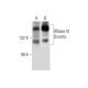 western blotting image from recommended RNase III Drosha (C-7) monoclonal antibody replacement. Image 296931