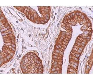 RNase L Antibody (E-9) - Immunohistochemistry - Image 374746 