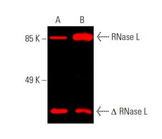 RNase L Antibody (E-9) - Western Blotting - Image 387018