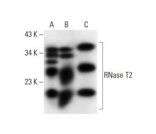 RNase T2 Antibody (E-5) - Western Blotting - Image 298108 