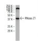 RNase Z1 Antibody (347.1) - Western Blotting - Image 34475