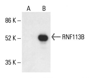 RNF113B Antibody (A-8) - Western Blotting - Image 411152 