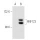 RNF123 Antibody (267.1) - Western Blotting - Image 32545