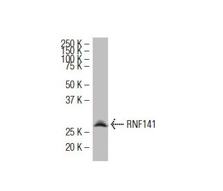 RNF141 Antibody (J-23) - Western Blotting - Image 34481 