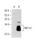 RNF141 Antibody (J-23) - Western Blotting - Image 109350